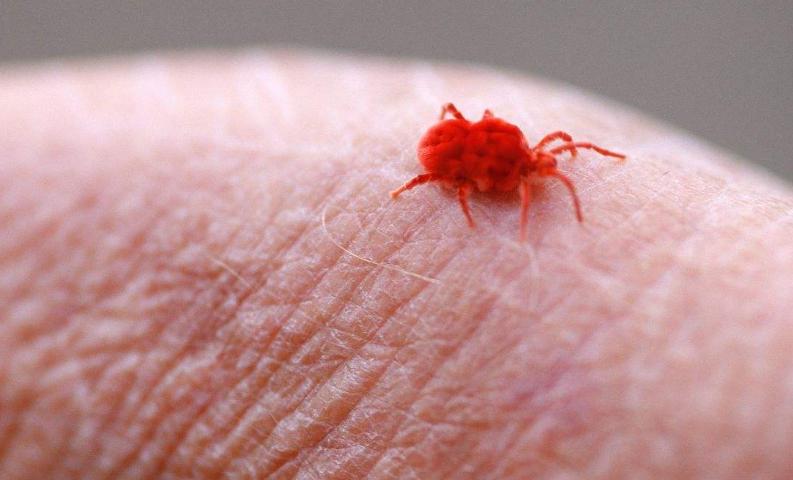 螨虫图片大全介绍,怎样去除床上的螨虫