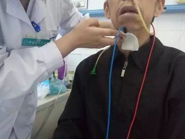 治病手工,纯手工修复真是高手在民间