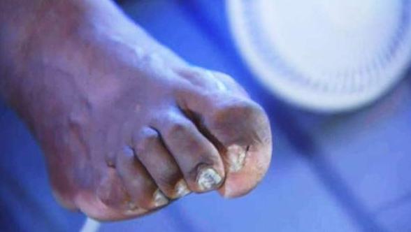 nba球星穿耐克鞋受伤,nba球员职业病