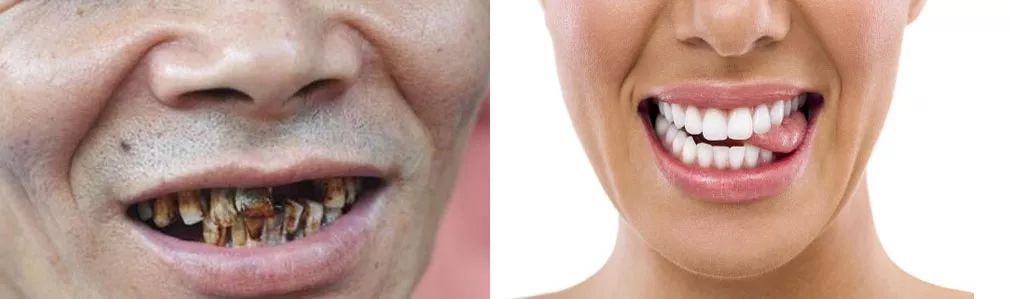 是不是全世界的男人,都用抽烟来纾解郁闷?