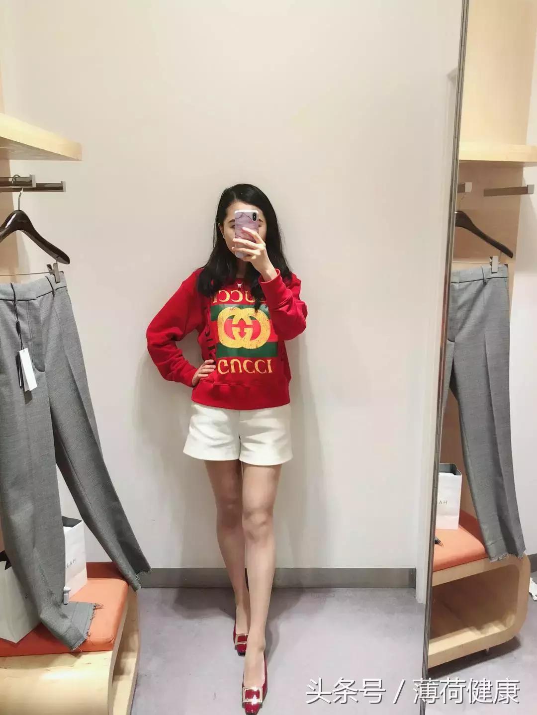 轻度XO型腿改善后,我的双腿明显变长