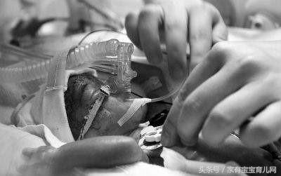 警惕!早产儿会有很多并发症的可能!如何避免?