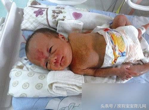 警惕!早产儿会有很多并发症的可能!如何避免?