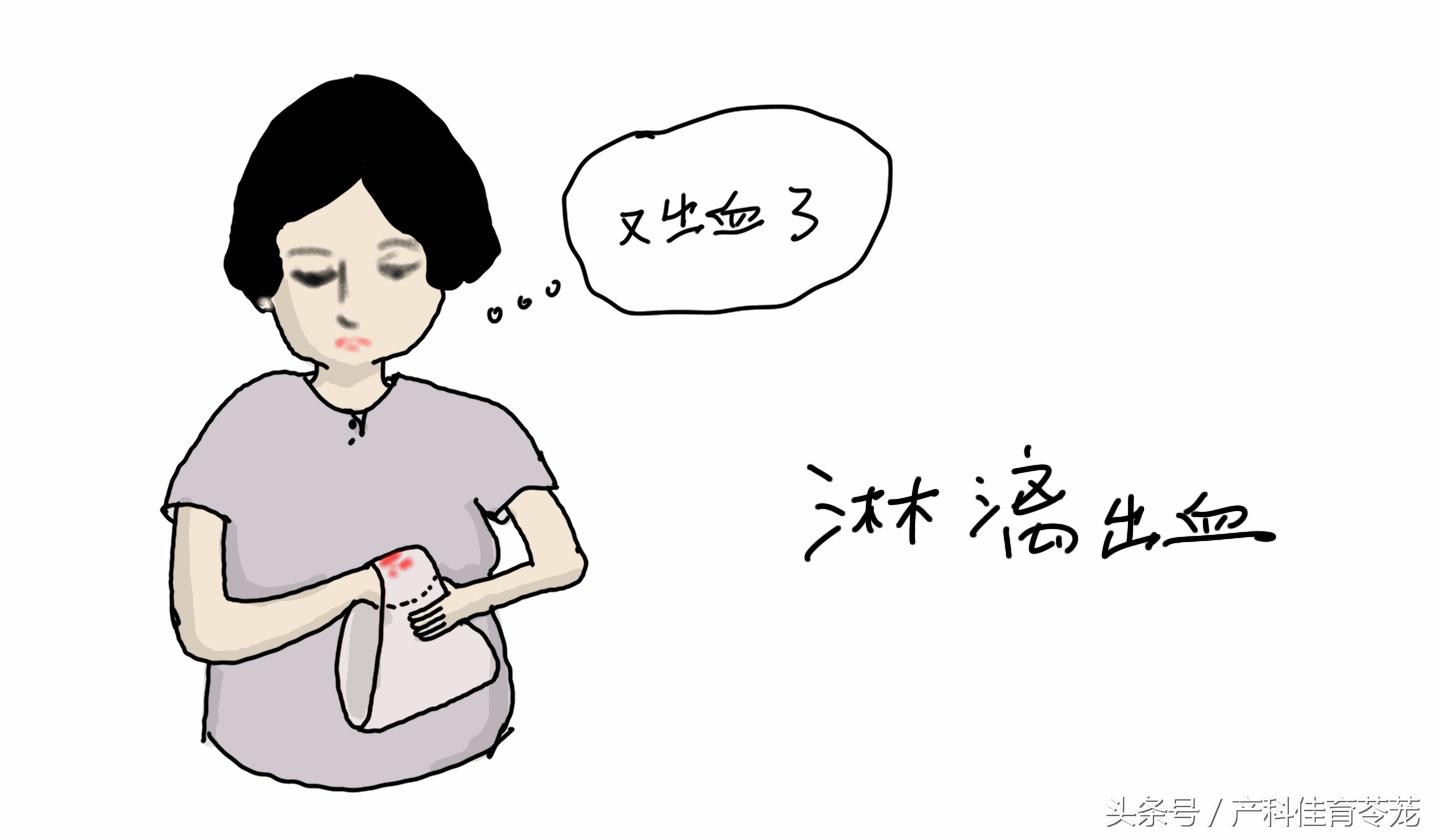 曼月乐摘环之前需要做什么,上曼月乐环之前要打什么针