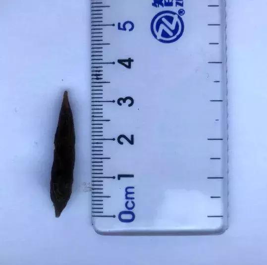 如果误吞了枣核怎么办,误吞了一个枣核怎么办