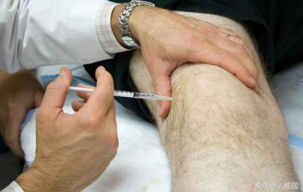 膝盖长期痛怎么办,膝盖痛有什么好方法治疗