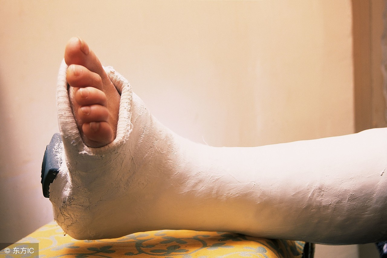 青少年骨折没完全复位,年轻小伙骨折半年不愈合怎么办