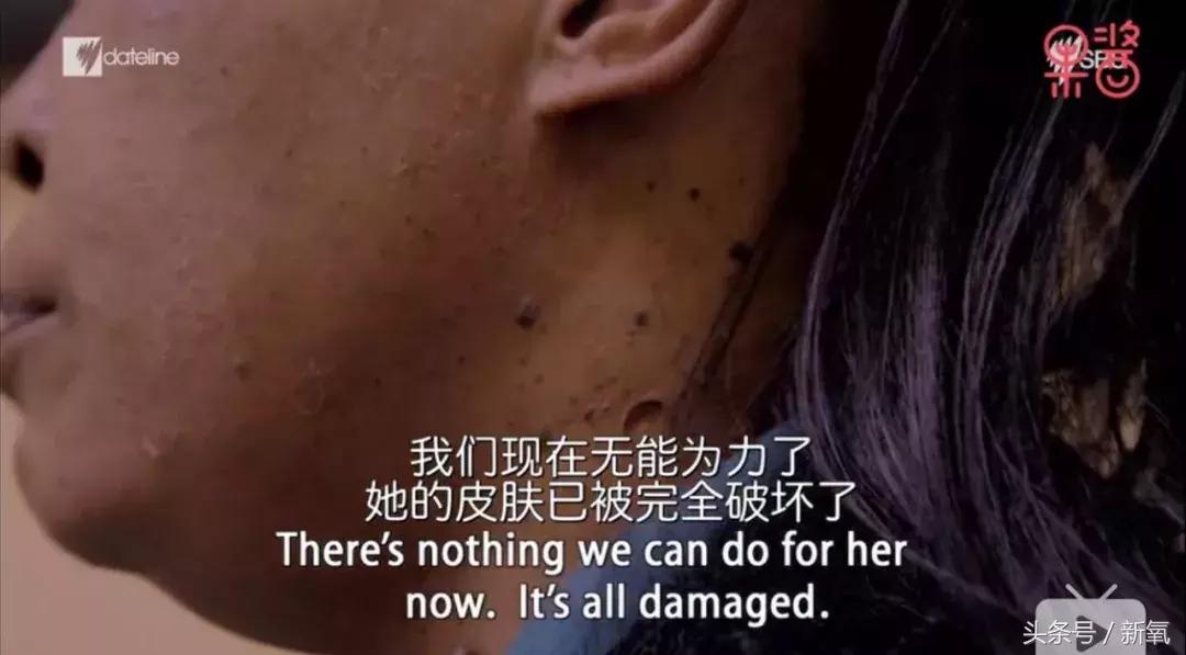 日界线纪录片：南非黑人惨痛疯狂的漂白皮肤史