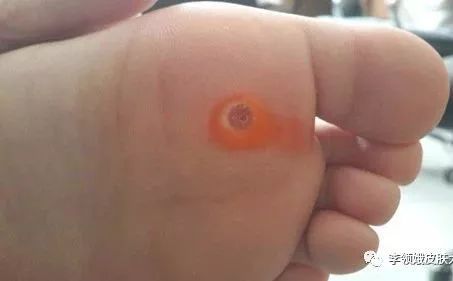 杏林微科普帮您认识各类头晕,杏林微科普最新消息