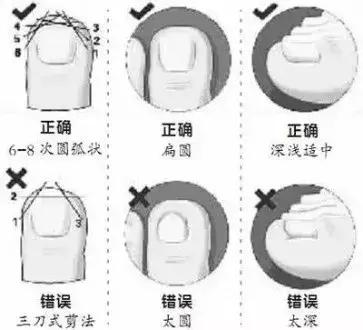 跑步跑到脚趾甲盖里面有水泡图片,跑步脚上出现黑趾甲该怎么处理