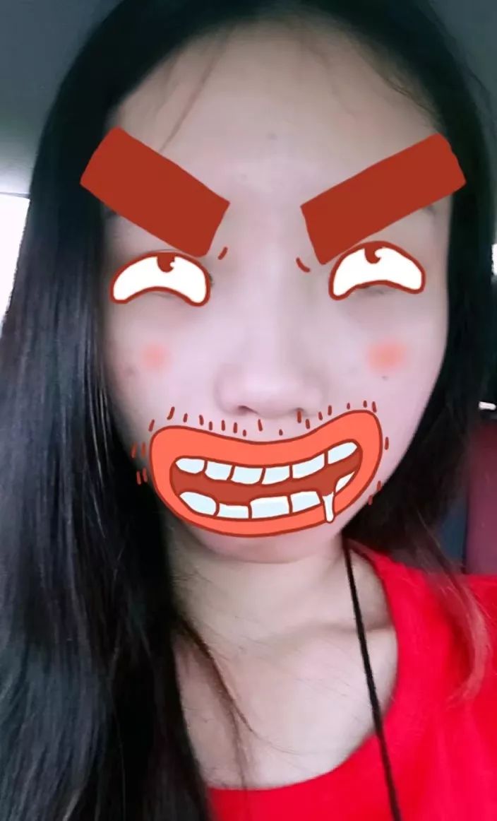 作为一个长痘痘多年的人,分享给痘友抗痘经历