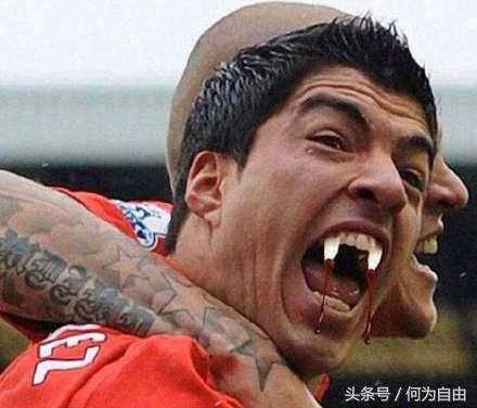 体育禁令,足球比赛不允许咬人