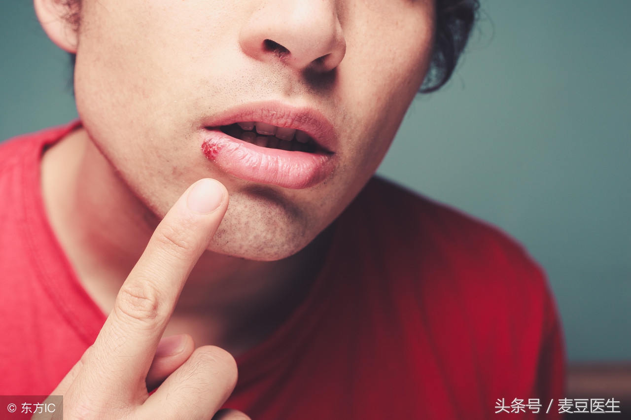 口腔溃疡特别疼怎么缓解,得了口腔溃疡怎样缓解疼痛更有效