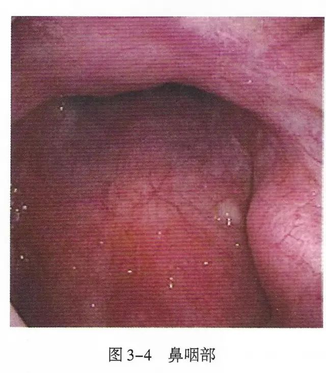 上呼吸道解剖视频教程,呼吸道生理与解剖课件