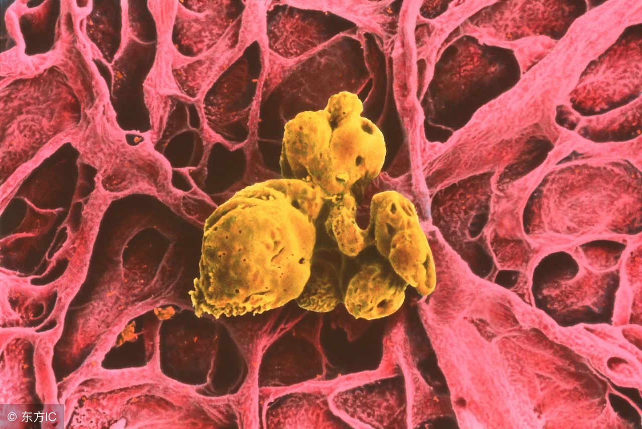 胆结石腹痛是哪个地方痛,胆结石疼痛的症状有哪些