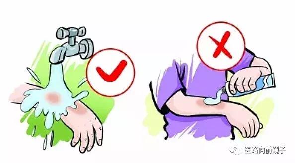 狗咬伤用什么药最有效,小孩被狗咬伤偏方