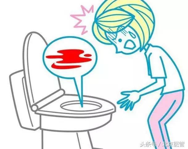 想做无痛胃肠镜？检查前这些注意事项必读！