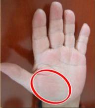 手上的健康秘密,手诊10种常见病从手上就能看出来