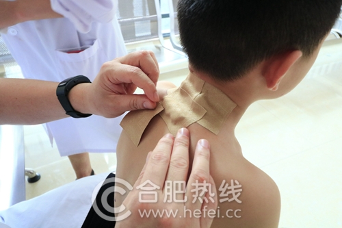 安徽省中医院2018年“冬病夏治”特色诊疗活动正式启动