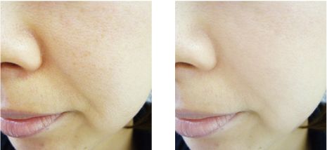 公认最好的温和去黑头产品测评,去黑头比较好用的产品