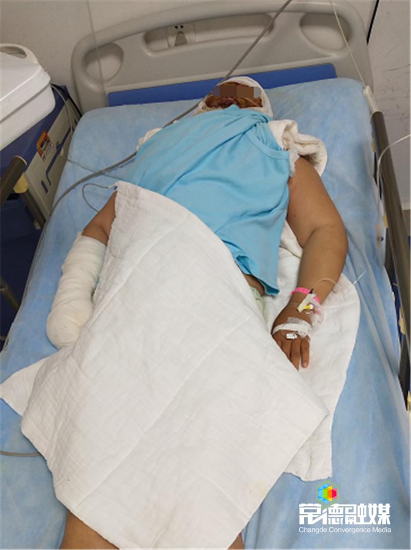 一家7人端午聚会5人烧伤独生女计穷力竭盼帮忙