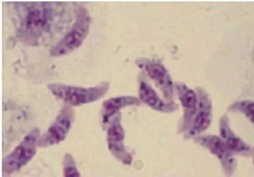 “义”正听｜黄瓜中有杀不死的寄生虫？真相是……