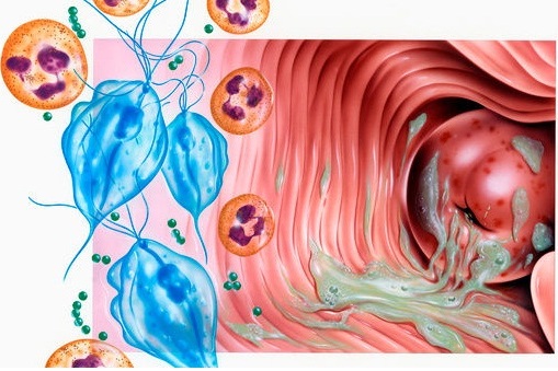 女人发肿是什么原因,女人身上有点肿是什么问题