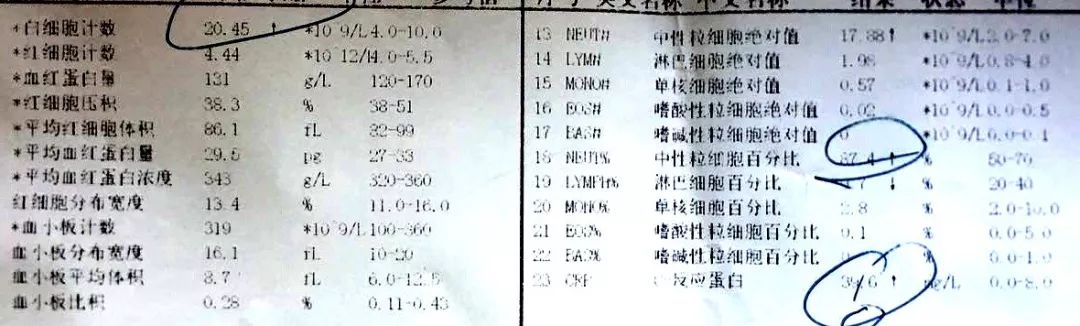 孩子发烧查血说细菌感染怎么回事,孩子反复发烧去检查说是细菌感染