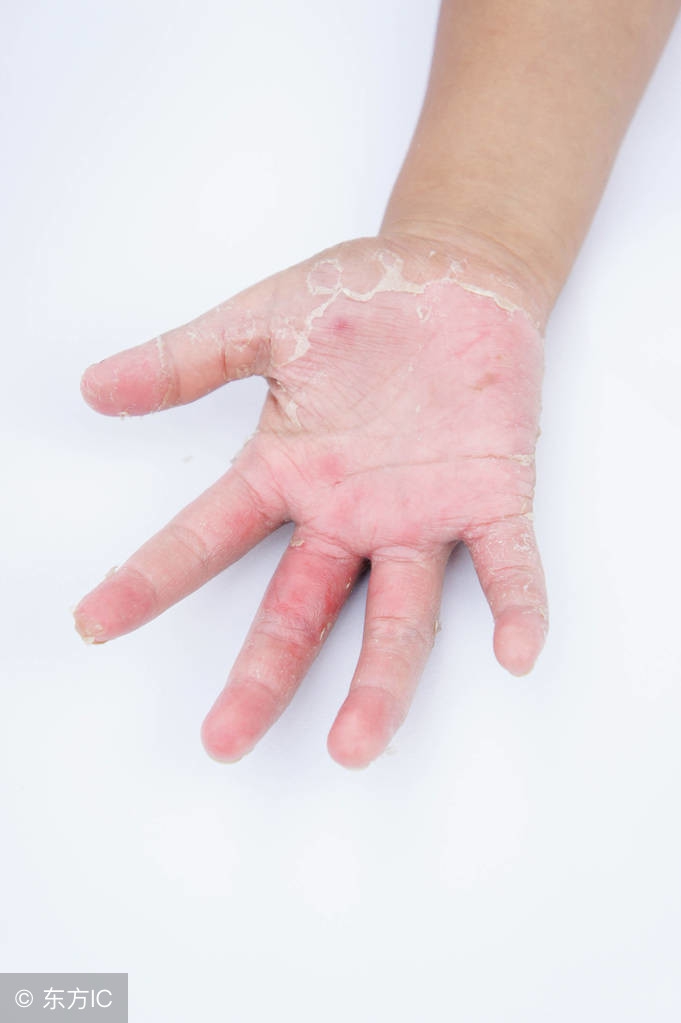 拒绝糖尿病从我做起,给糖尿病患者的忠告