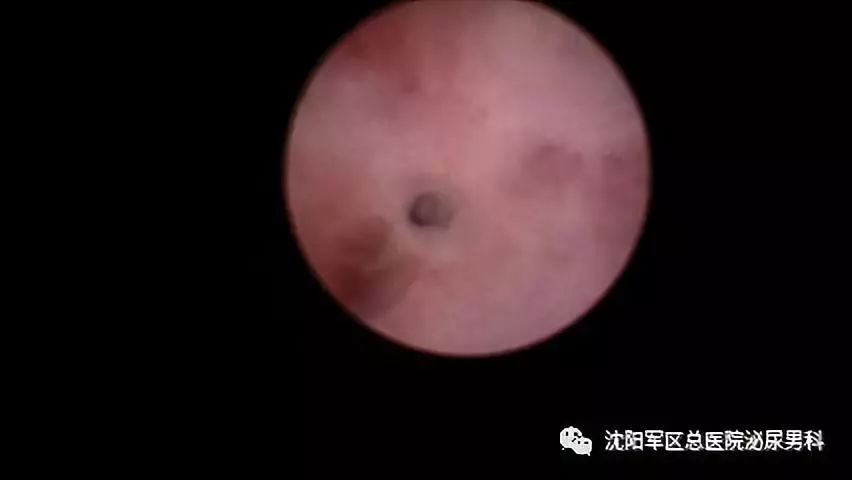 周一专家号（第69期）-尿道修复、修前必读