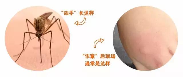 蚊虫咬了小宝宝,蚊虫咬了儿童用什么药