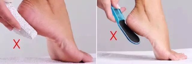 擦掉一张皮，双脚换皮术！死皮、老茧一喷就没，15秒还原嫩白玉足