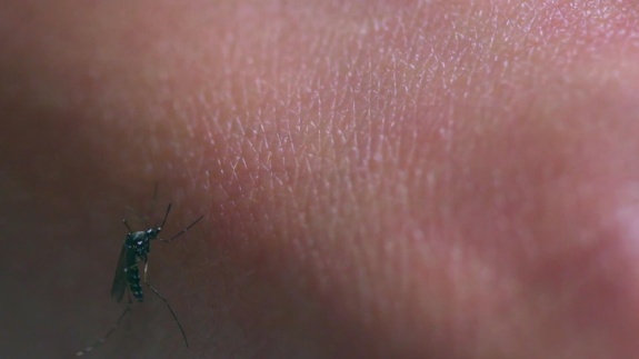 这个吻，竟然致命