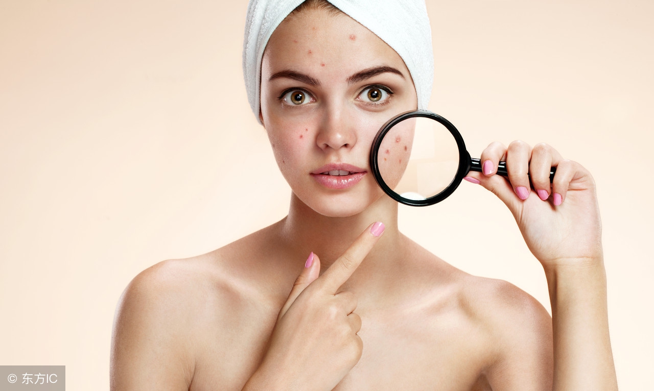 黑头闭口痘痘怎么区别,痘痘黑头闭口用什么