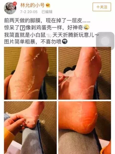 林允没整之前的样子,林允回应撕脚皮视频