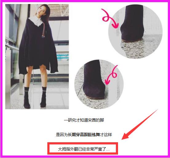 林允的脚是扁平足吗,林允脚皮