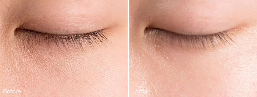 眼霜种草好物推荐去细纹,好物分享超级好用的眼霜