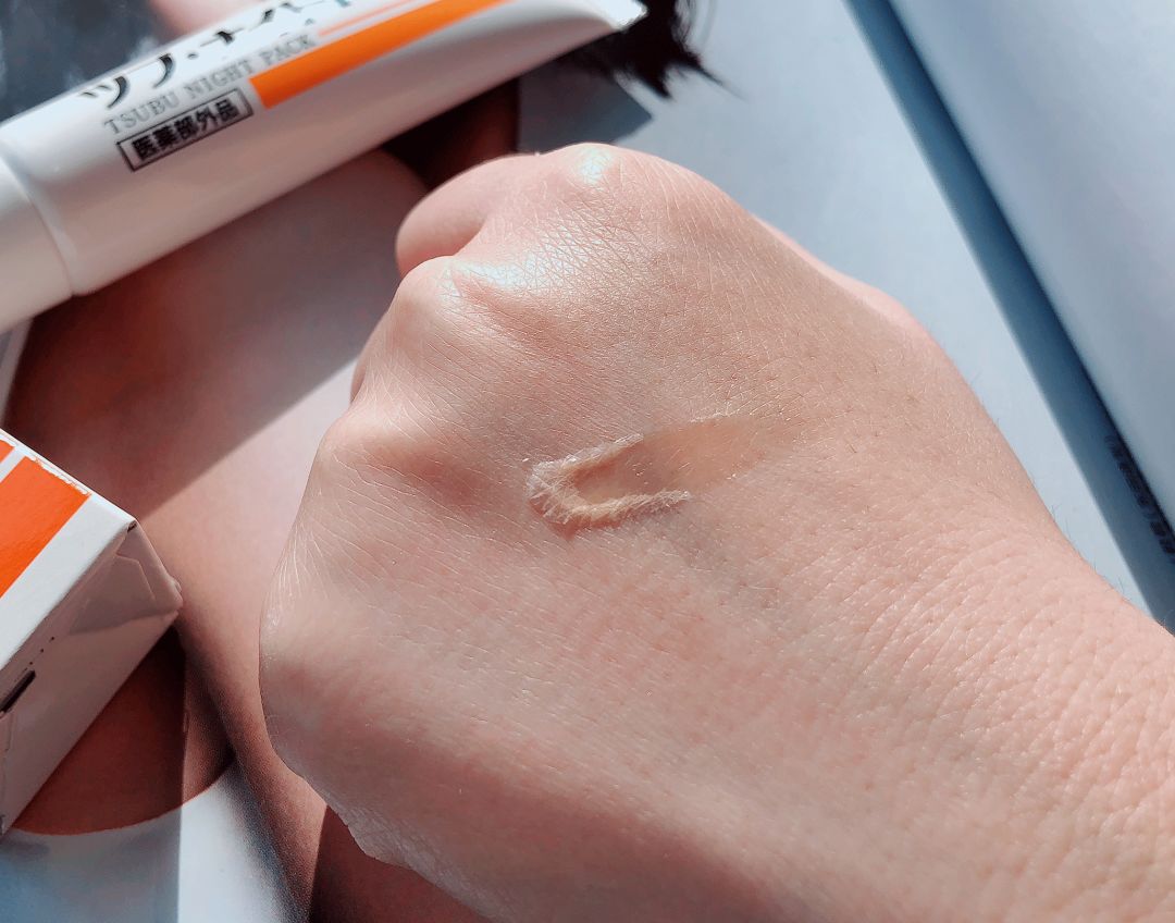 不用针挑手指扎进刺了怎么办,不用针挑就能挑出刺的方法