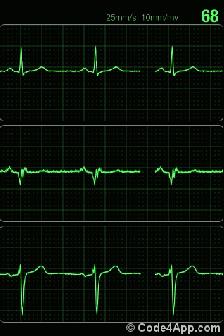 这项最便宜的检查,你做了吗?