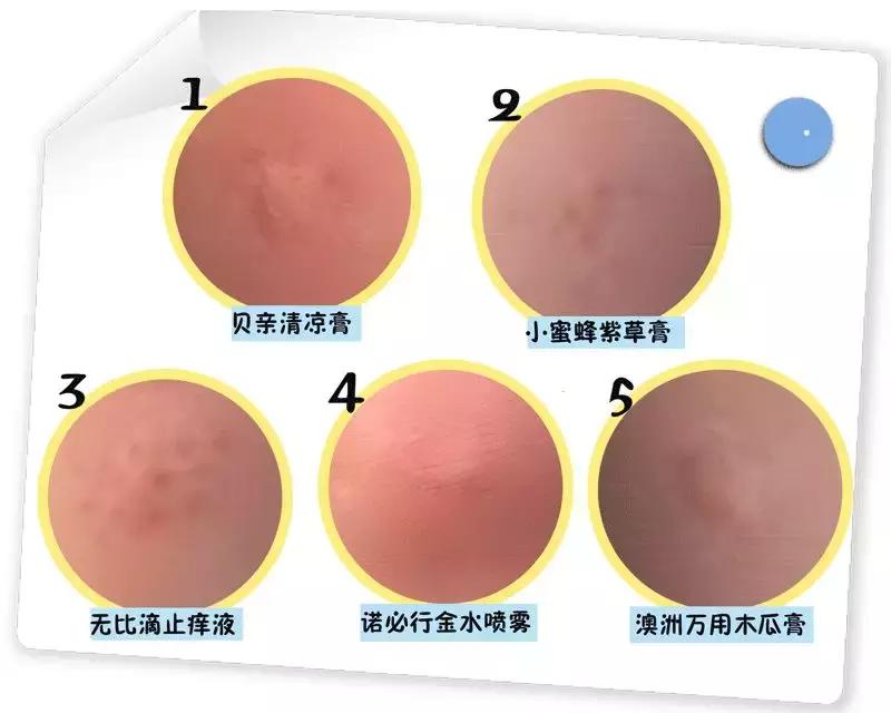 宝宝被蚊子叮了怎么止痒消肿？测评后我发现网红产品竟然最有用！
