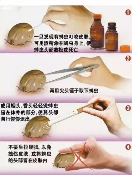 一家三口被刺身亡案,江苏一家三口被不知名虫子叮咬