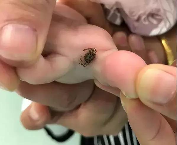 一家三口被刺身亡案,江苏一家三口被不知名虫子叮咬