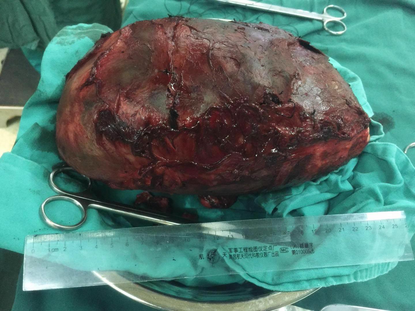 郑大一附院河医区手术室,河大一附院手术室