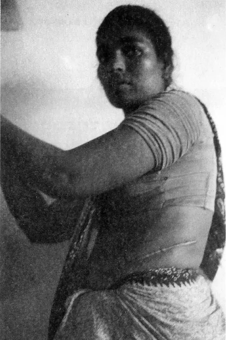 猎奇I世界人体交易秘史——一觉醒来肝和肾全没了