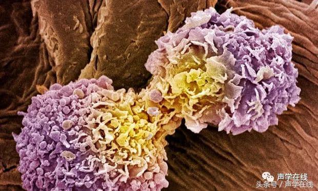 我不是药神惹怒众多癌症患者,我不是药神播出后对医药的影响