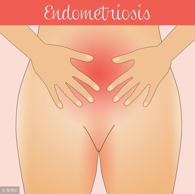 宫颈息肉如果是恶性的有什么症状,宫颈息肉有6个前兆严重吗