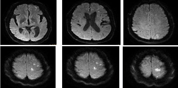 心血管内科急救流程,急诊静脉用药方法