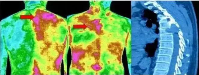 这个仪器好神奇：红黄蓝绿，扫描后身体病症成像仿佛是气象云图