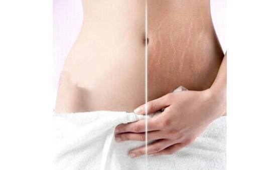 孕妇橄榄油哪个比较好吸收不油腻,孕妇推荐用哪款橄榄油