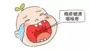 孩子发烧父母立马就能察觉,家长发烧呕吐